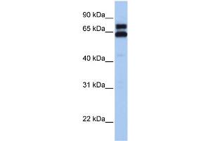 WB Suggested Anti-HSPD1 Antibody Titration:  0. (HSPD1 antibody  (C-Term))