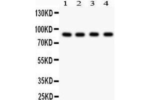 Western Blotting (WB) image for anti-Furin (Paired Basic Amino Acid Cleaving Enzyme) (FURIN) (AA 591-794) antibody (ABIN3042409) (FURIN antibody  (AA 591-794))