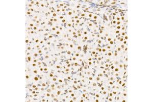 Immunohistochemistry of paraffin-embedded rat ovary using TCE Rabbit mAb (ABIN7270877) at dilution of 1:25 (40x lens). (TCEA1 antibody)