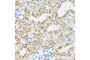 Immunohistochemistry of paraffin-embedded human stomach using SLC30 antibody (2532) at dilution of 1:100 (40x lens).