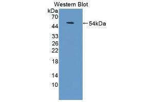 Western blot analysis of the recombinant protein. (CD58 antibody  (AA 1-214))