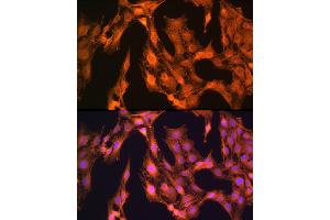 Immunofluorescence (IF) image for anti-LIM and SH3 Protein 1 (LASP1) (AA 130-205) antibody (ABIN1680664)