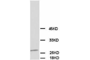 Image no. 1 for anti-Calbindin (CALB1) antibody (ABIN1502005) (CALB1 antibody)