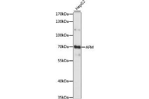 Western blot analysis of extracts of HepG2 cells, using AFM antibody (ABIN7265511) at 1:1000 dilution. (Afamin antibody  (AA 260-599))