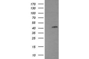 Image no. 1 for anti-Epidermal Growth Factor Receptor (EGFR) antibody (ABIN1497964) (EGFR antibody)