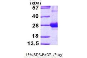 SDS-PAGE (SDS) image for RAB7A, Member RAS Oncogene Family (RAB7A) (AA 1-207) protein (His tag) (ABIN667328) (RAB7A Protein (AA 1-207) (His tag))