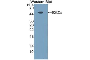Western blot analysis of the recombinant protein. (TLR10 antibody  (AA 617-784))