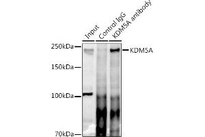 Immunoprecipitation analysis of 300 μg extracts of HeLa cells using 3 μg KDM5A antibody (ABIN6131816, ABIN6142800, ABIN6142801 and ABIN6223074). (KDM5A antibody)