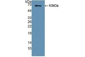 Detection of Recombinant YARS, Human using Polyclonal Antibody to Tyrosyl tRNA Synthetase (YARS) (YARS antibody  (AA 2-528))