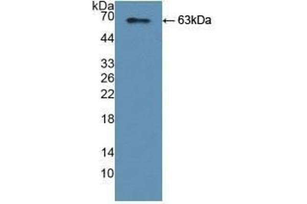YARS antibody  (AA 2-528)