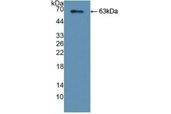 YARS anticorps  (AA 2-528)