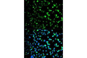 Immunofluorescence analysis of HeLa cell using TYMP antibody. (Thymidine Phosphorylase antibody  (AA 1-200))