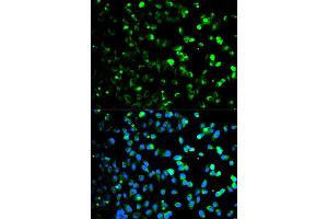 Immunofluorescence analysis of HeLa cell using TYMP antibody. (Thymidine Phosphorylase antibody  (AA 1-200))