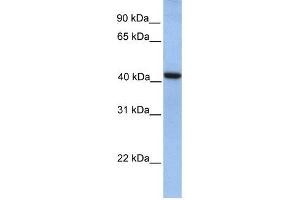 GMPPA antibody used at 1 ug/ml to detect target protein. (GMPPA antibody  (N-Term))