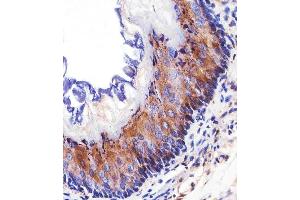 Immunohistochemistry (Paraffin-embedded Sections) (IHC (p)) image for anti-Epidermal Growth Factor Receptor (EGFR) (AA 1163-1191), (C-Term) antibody (ABIN1882237)