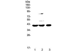 Western blot testing of 1) rat spleen, 2) rat liver and 3) mouse testis lysate with PPID antibody at 0.