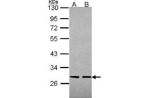 WB Image Sample (30 ug of whole cell lysate) A: 293T B: A431 , 12% SDS PAGE antibody diluted at 1:2000