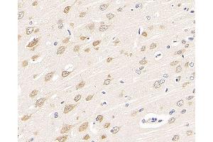 Immunohistochemistry analysis of paraffin-embedded rat brain using RBFOX3 Polyclonal Antibody at dilution of 1:300. (NeuN antibody)