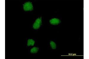 Immunofluorescence of purified MaxPab antibody to SMA4 on HeLa cell. (SMN1 antibody  (AA 1-140))