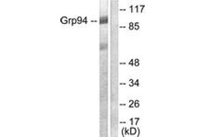 Western blot analysis of extracts from SKOV3 cells, using GRP94 Antibody. (GRP94 antibody  (AA 754-803))