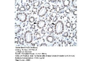 Human kidney (CITED1 antibody  (Middle Region))