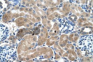 Image no. 1 for anti-Syndecan Binding Protein (Syntenin) (SDCBP) (AA 101-150) antibody (ABIN205051) (SDCBP antibody  (AA 101-150))