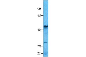 Host:  Rabbit  Target Name: SMAD7    Sample Type:  Human Lung  Antibody Dilution:  1. (SMAD7 antibody  (N-Term))