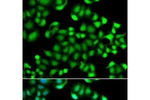 Immunofluorescence analysis of A549 cells using MAPKAPK3 Polyclonal Antibody (MAPKAP Kinase 3 antibody)