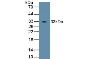 Detection of Recombinant OSX, Human using Polyclonal Antibody to Osterix (OSX)