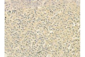 ABIN6260771 and ABIN6279279 at 1/100 staining human pituitary adenoma by IHC-P. (CEP72 antibody  (Internal Region))