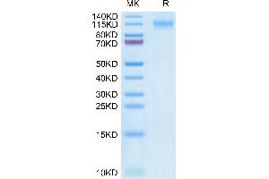 Human FLT3 on Tris-Bis PAGE under reduced condition. (FLT3 Protein (AA 27-541) (Fc Tag))