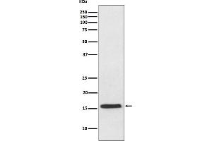 Western blot analysis of VAMP2 expression in mouse brain lysate. (Recombinant VAMP2 antibody)