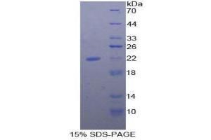 SDS-PAGE (SDS) image for Fibrillin 1 (FBN1) (AA 1703-1889) protein (His tag) (ABIN1879754) (Fibrillin 1 Protein (FBN1) (AA 1703-1889) (His tag))
