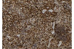 ABIN6264009 and ABIN6272859 at 1/100 staining Mouse spleen tissue by IHC-P.