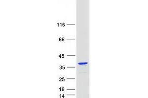 Validation with Western Blot