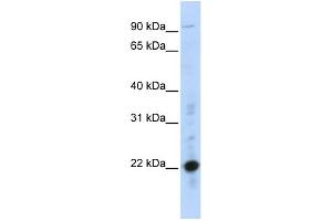 WB Suggested Anti-CRIP2 Antibody Titration:  0. (CRIP2 antibody  (Middle Region))