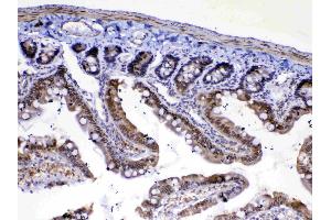 IHC analysis of MED4 using anti-MED4 antibody . (MED4 antibody  (AA 27-140))