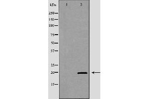 Western blot analysis of extracts of K562, using KLRD1 antibody. (CD94 antibody  (C-Term))