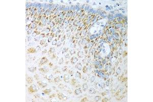 Immunohistochemistry of paraffin-embedded human esophagus using FDXR antibody at dilution of 1:100 (40x lens).