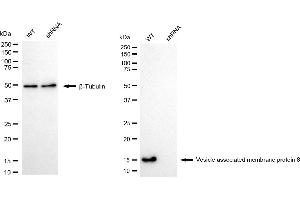 Western blotting analysis using vesicle associated membrane protein 8 antibody (ABIN7800832). (Recombinant VAMP8 antibody)