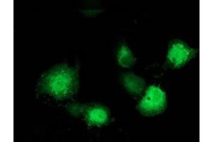 Anti-MAPRE2 mouse monoclonal antibody (ABIN2454543) immunofluorescent staining of COS7 cells transiently transfected by pCMV6-ENTRY MAPRE2 (RC200259). (MAPRE2 antibody)