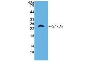 Detection of Recombinant a1M, Mouse using Polyclonal Antibody to Alpha-1-Microglobulin (a1M) (AMBP antibody  (AA 18-202))