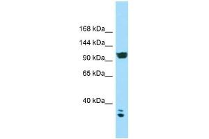 WB Suggested Anti-CACNA2D2 Antibody Titration: 1. (CACNA2D2 antibody  (C-Term))