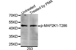 Western blot analysis of extracts of 293 cell line, using Phospho-MAP2K1-T286 antibody. (MEK1 antibody  (pThr285))