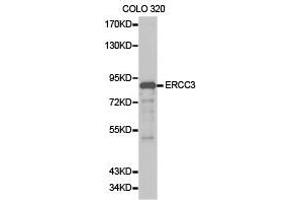 Western Blotting (WB) image for anti-DNA Repair Protein Complementing XP-B Cells (ERCC3) antibody (ABIN1872578) (ERCC3 antibody)