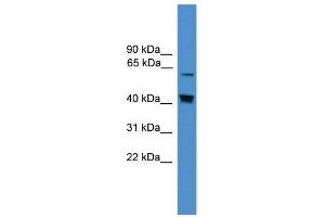 Western Blotting (WB) image for anti-Eukaryotic Translation Initiation Factor 2-alpha Kinase 2 (EIF2AK2) (Middle Region) antibody (ABIN2774645)
