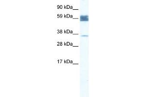 WB Suggested Anti-ZNF713 Antibody Titration:  1. (ZNF713 antibody  (N-Term))