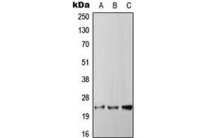 Western blot analysis of RGS4 expression in HepG2 (A), SP2/0 (B), PC12 (C) whole cell lysates. (RGS4 antibody  (Center))