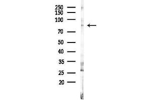anti-Arachidonate 5-Lipoxygenase (ALOX5) (C-Term) antibody