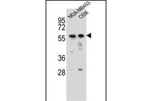 FOXD4 Antibody (Center) (ABIN656115 and ABIN2845454) western blot analysis in MDA-M,CEM cell line lysates (35 μg/lane). (FOXD4 antibody  (AA 182-210))